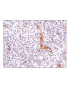 Cell Signaling Cd105/Endoglin (3a9) Mouse mAb