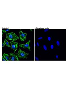 Cell Signaling Phospho-Myosin Iia (Ser1943) (D7z7t) Rabbit mAb