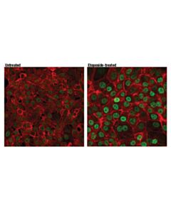 Cell Signaling P73 (D3g10) Rabbit mAb