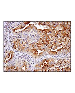 Cell Signaling Lamtor5/Hbxip (D4v4s) Rabbit mAb