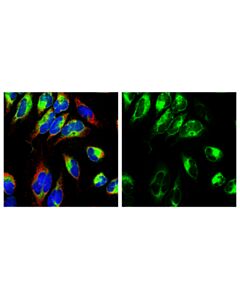 Cell Signaling Sec61b (D5q1w) Rabbit mAb
