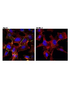 Cell Signaling Mrp1/Abcc1 (D7o8n) Rabbit mAb