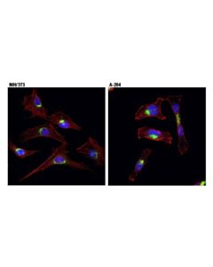 Cell Signaling Vti1a (D8u3m) Rabbit mAb