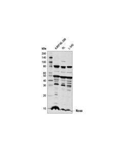 Cell Signaling Noxa (D8L7U) Rabbit mAb 20 uL