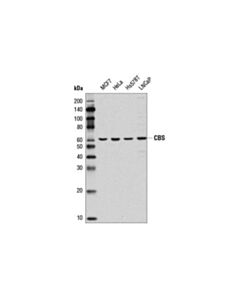 Cell Signaling Cbs (D8f2p) Rabbit mAb