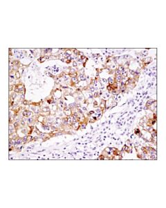 Cell Signaling Lsr (D3e3n) Xp Rabbit mAb