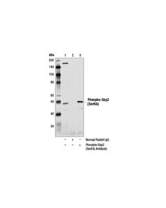 Cell Signaling Phospho-Skp2 (Ser64) Antibody