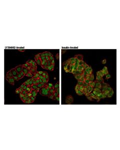 Cell Signaling Foxo1 (D7c1h) Mouse mAb