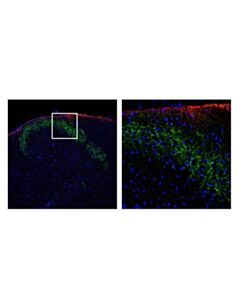 Cell Signaling Cgrp (D5r8f) Rabbit mAb