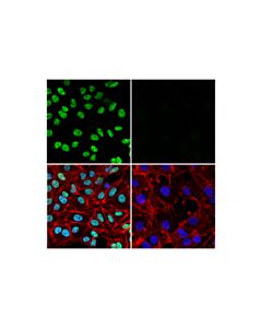Cell Signaling Prox1 (D2j6j) Rabbit mAb