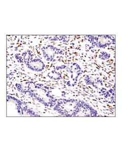 Cell Signaling Ifi16 (D8b5t) Rabbit mAb