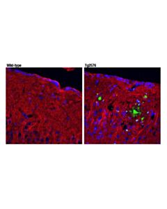 Cell Signaling Beta-Amyloid (Pe3 Peptide) (D5n5h) Rabbit mAb