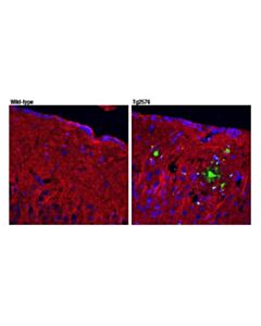 Cell Signaling Beta-Amyloid (Pe3 Peptide) (D5n5h) Rabbit mAb
