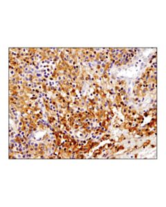 Cell Signaling Stat1 (D1k9y) Rabbit mAb