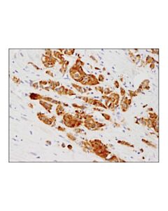 Cell Signaling Phospho-Tau (Ser416) (D7u2p) Rabbit mAb