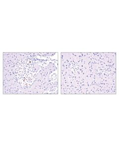 Cell Signaling Cre Recombinase (D7l7l) Xp Rabbit mAb