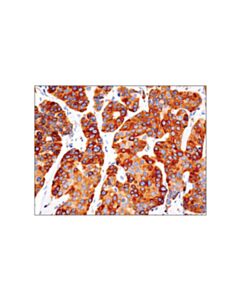 Cell Signaling Bcl-2 (124) Mouse mAb