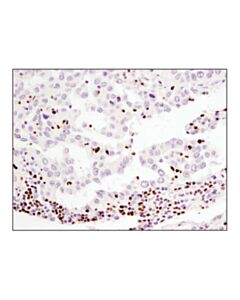 Cell Signaling Aiolos (D1c1e) Rabbit mAb