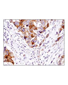 Cell Signaling Smac/Diablo (D5s3r) Rabbit mAb