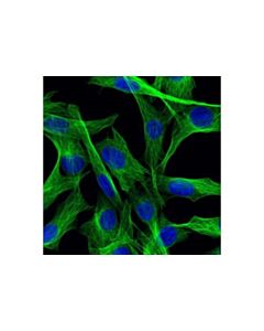 Cell Signaling Beta-Tubulin (D2n5g) Rabbit mAb
