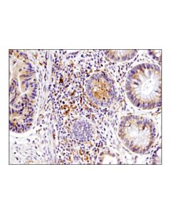 Cell Signaling Igf-Ii Receptor/Ci-M6pr (D8z3j) Rabbit mAb