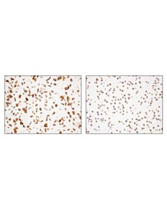 Cell Signaling Alpha-Actinin 4 (D7u5a) Rabbit mAb 