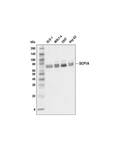 Cell Signaling Dcp1a (D6v1r) Rabbit mAb