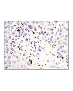 Cell Signaling Lag3 (D2g4o) Xp Rabbit mAb
