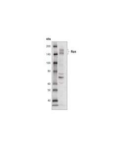 Cell Signaling Ron (C81h9) Rabbit mAb (Biotinylated)