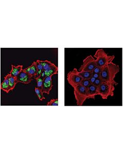 Cell Signaling Malic Enzyme 2 (E1n3e) Xp Rabbit mAb