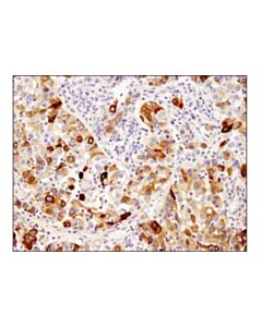 Cell Signaling Tff1/Ps2 (D2y1j) Rabbit mAb