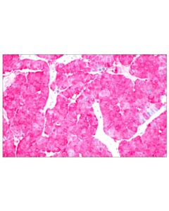 Cell Signaling Signalstain ® Boost Ihc Detection Reagent (Ap, Rat)