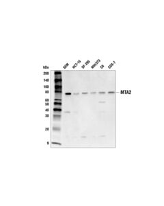 Cell Signaling Mta2 Antibody