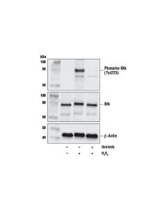 Cell Signaling Ibrutinib