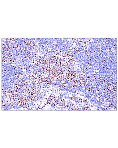 Cell Signaling TCF1/TCF7 (E6O1K) Rabbit mAb 20 uL