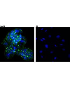 Cell Signaling Car (D3w3g) Rabbit mAb