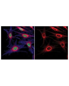 Cell Signaling Rab7 (D95f2) Xp Rabbit mAb (Alexa Fluor 555 Conjugate)