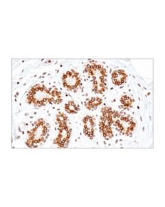 Cell Signaling Lamin B1 (E6m5t) Rabbit mAb