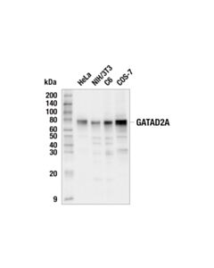 Cell Signaling Gatad2a (E7b5b) Rabbit mAb