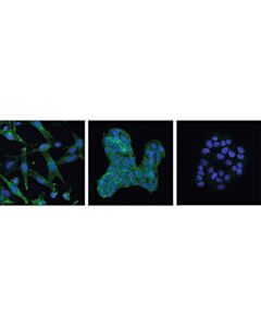 Cell Signaling Tyro/Axl/Mer Activation Antibody Sampler Kit