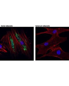 Cell Signaling Hsl (D6w5s) Xp Rabbit mAb