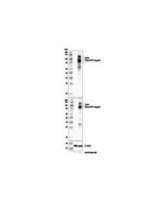 Cell Signaling Tnfrsf8/Cd30 (E7e4d) Rabbit mAb (BSA And Azide Free)