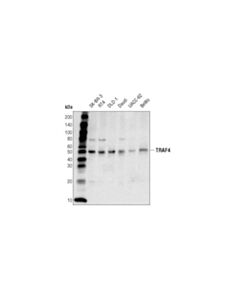 Cell Signaling TRAF4 (D1N3A) Rabbit mAb 20 uL