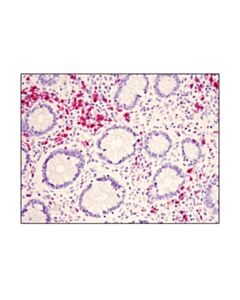 Cell Signaling Signalstain Boost Ihc Detection Reagent (Ap, Rabbit)