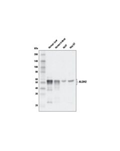 Cell Signaling Aldh2 Antibody