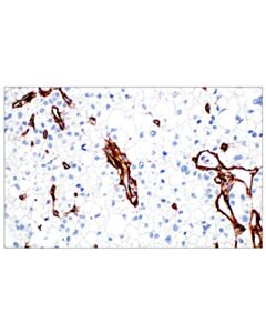 Cell Signaling COL4A1 (E5M6R) Rabbit mAb (IHC Formulated)