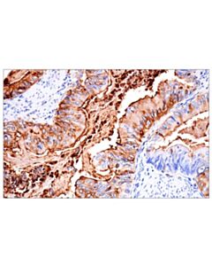 Cell Signaling CD177 (F9O5U) Rabbit mAb