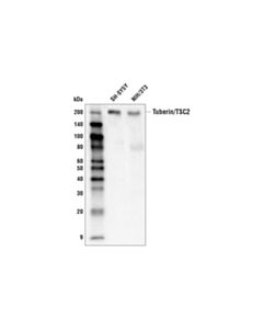 Cell Signaling Tuberin/Tsc2 (D93f12) Xp Rabbit mAb (Biotinylated)