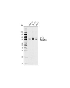 Cell Signaling St14/Matriptase Antibody