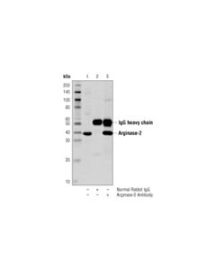 Cell Signaling Arginase-2 Antibody
